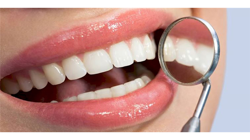 عوامل متعدد پوسیدگی دندان چیست
