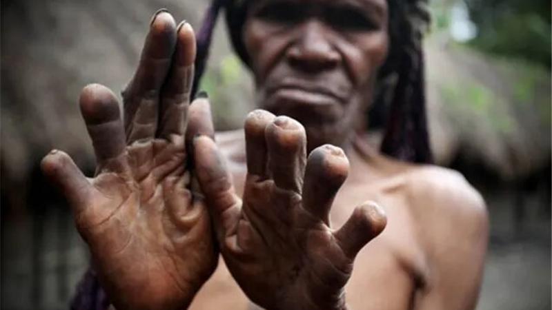 روشهایی برای دفن مردگان