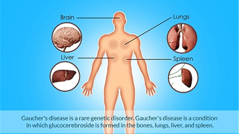 بیماری گوشه چیست و چطور درمان می شود
