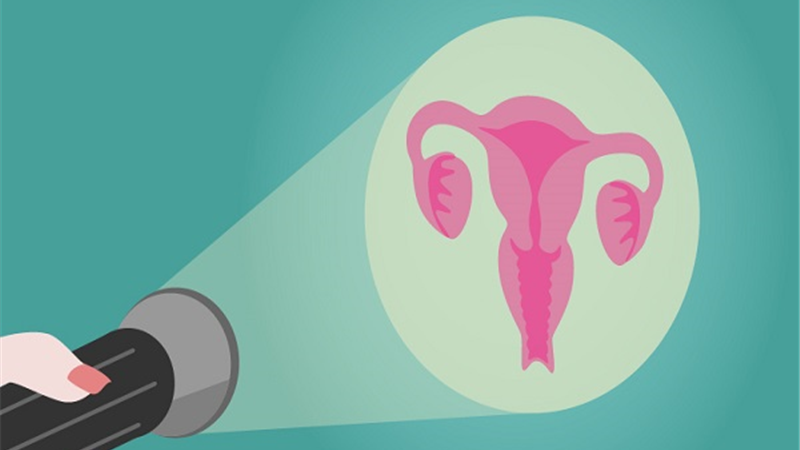 سرطان دهانه رحم چیست و چطور تشخیص و درمان می شود
