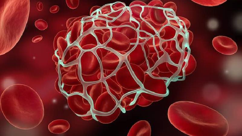 غلظت خون چیست و چه علایمی دارد و چه بخوریم غلظت خون نگیریم