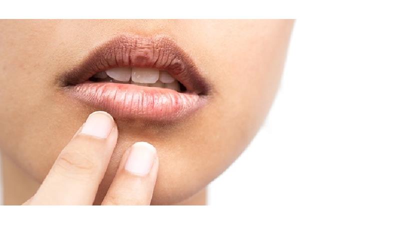 دلیل خشکی دهان چیست و چطور درمان می‌شود