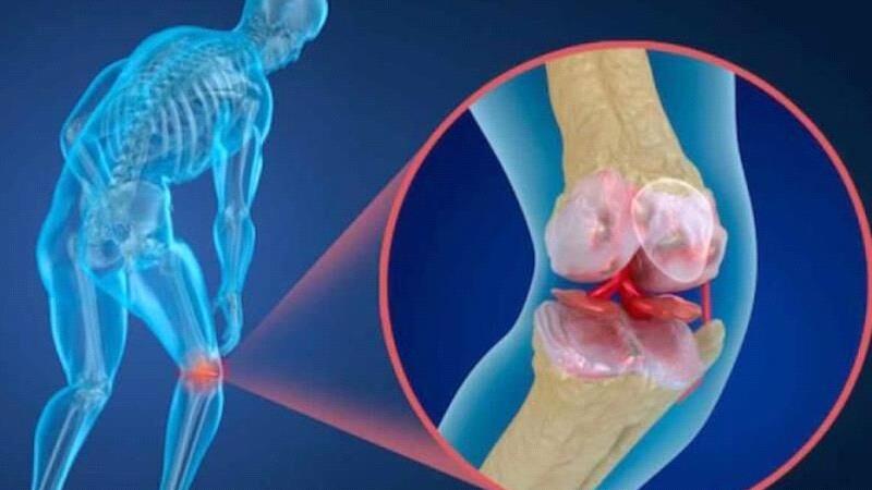 پوکی استخوان چیست؟