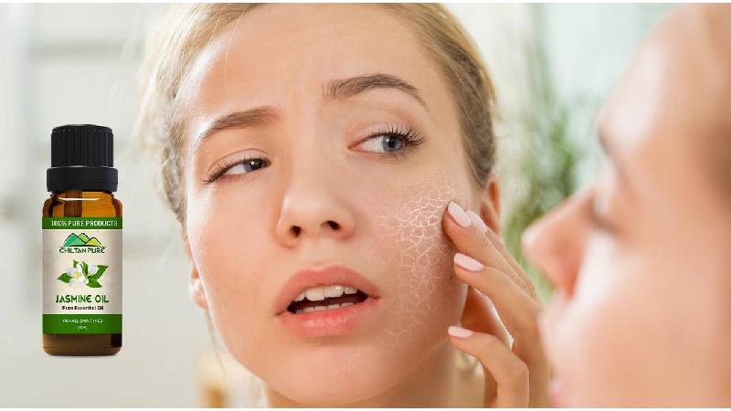 خواص حیرت انگیز روغن یاس ؛ از تقویت قوای جنسی تا جلوگیری از پیری پوست