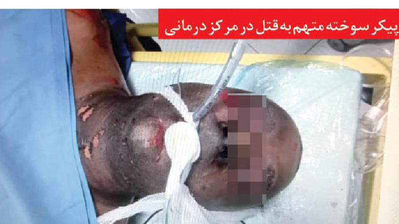 خودسوزی هولناک عامل قتل قبل از دستگیری