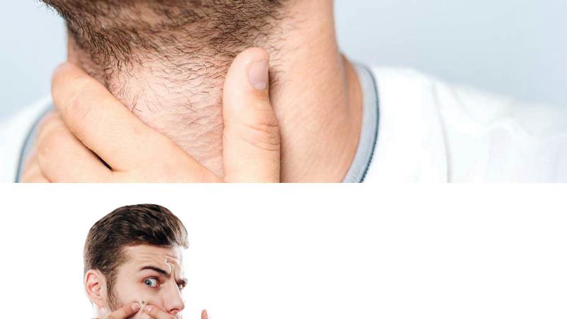 توده ها و برجستگی های روی پوست نشانه چیست