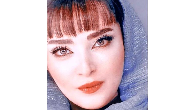 همه جراحی‌های زیبایی بهنوش طباطبایی ؛ از عمل بینی تا بلفاپلاستی