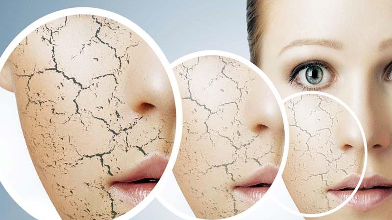 چند روش خانگی بسیار عالی برای رفع ترک های پوستی