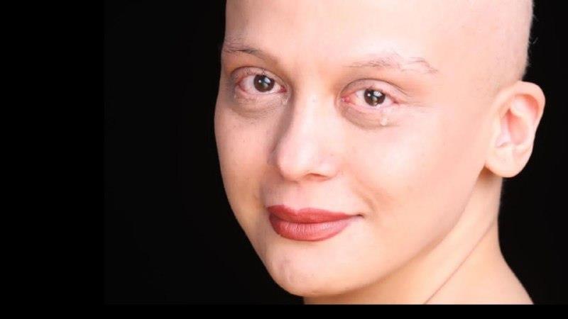 روایتی  دردناک از بیماری سخت سرطان مارال فرجاد