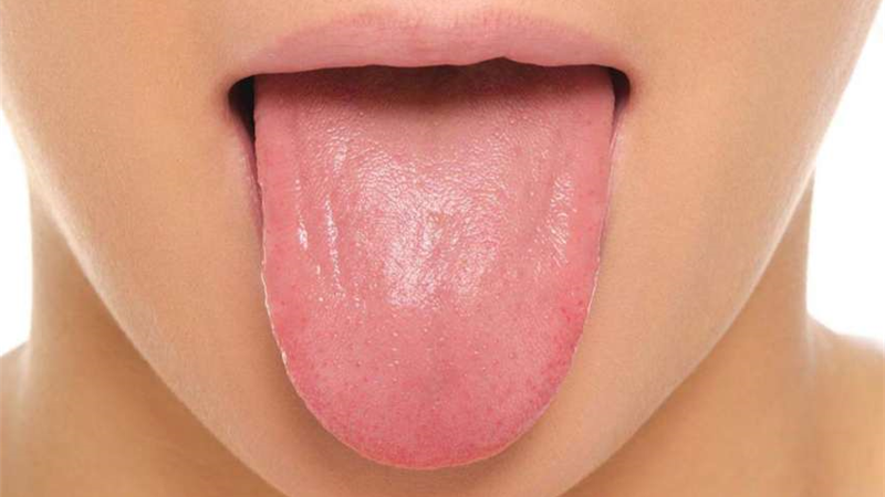 علت سفیدی زبان