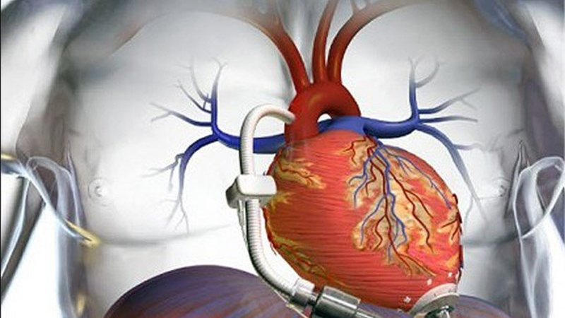 دلیل ضربان نامنظم قلب