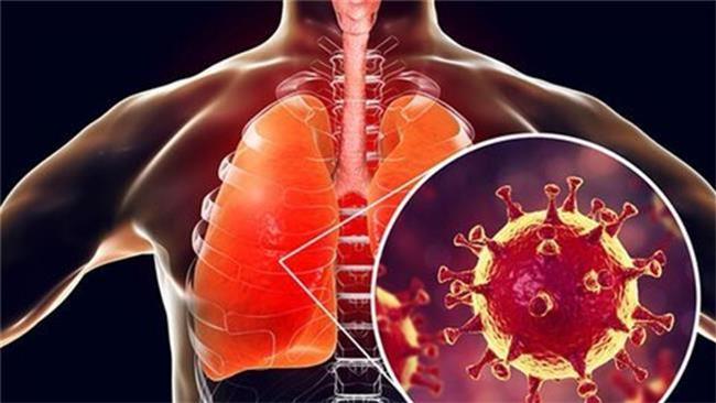 چه کسانی به کرونا مبتلا می شوند