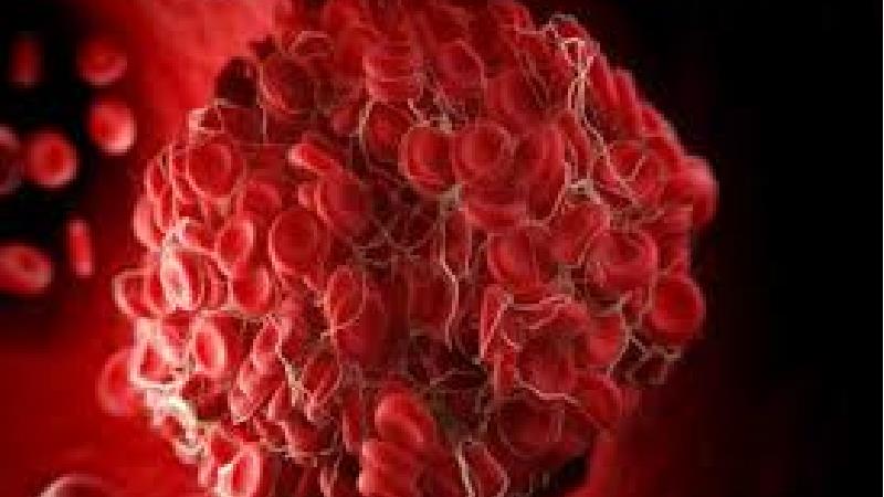 درمان غلظت خون