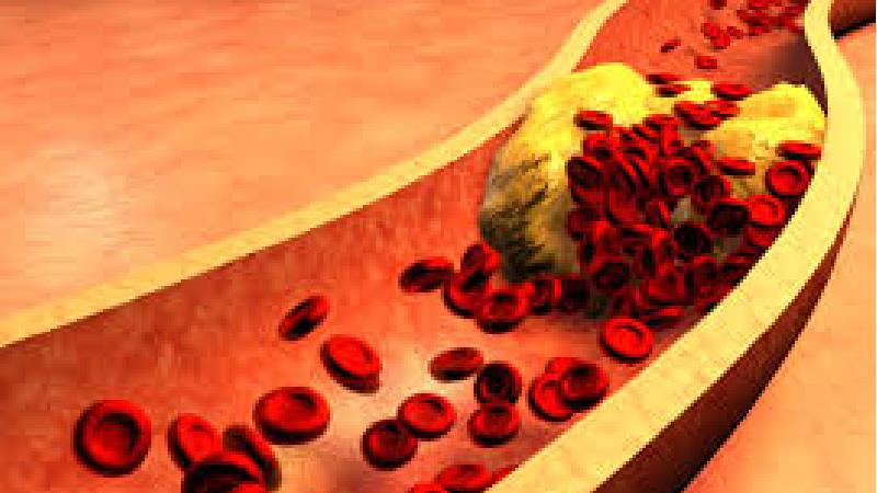 تری گلیسرید بالا چه عواقبی دارد