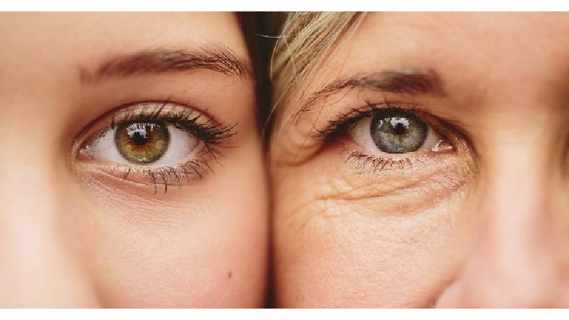 کلاژن سازی برای پوست