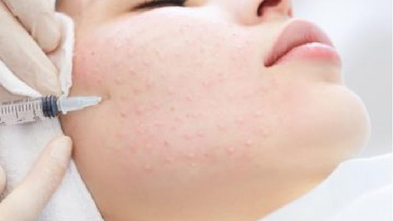 تفاوت مزوژل و ژل چیست