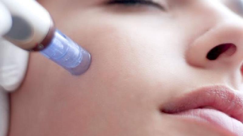 عوارض مزوژل