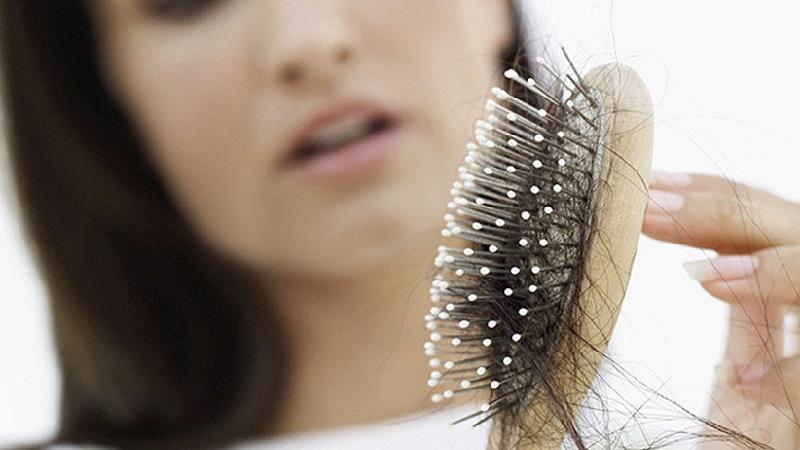 دلایل ریزش مو