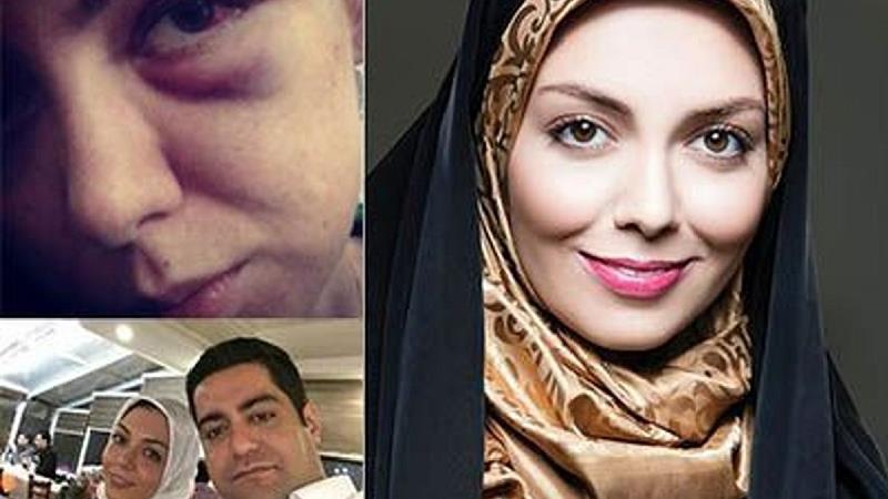 آزاده نامداری و فرزاد حسنی