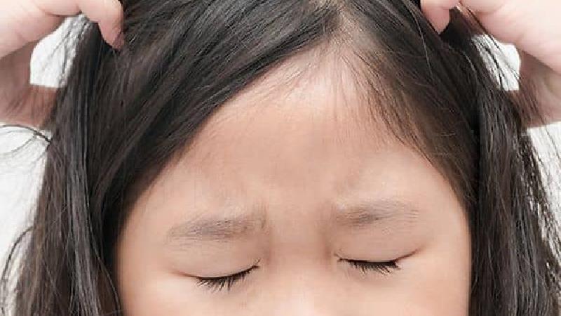 راه ازبین بردن شپش سر