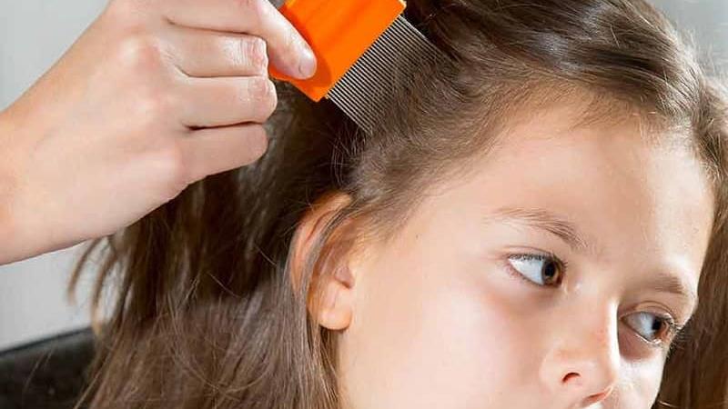 شانه مخصوص شپش سر