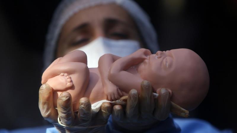 سقط جنین غیر قانونی