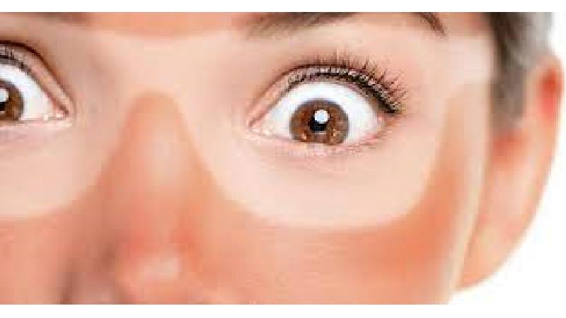 پماد  برای آفتاب سوختگی 