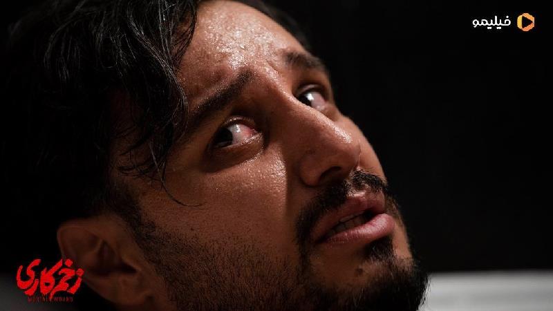 سریال زخم کاری