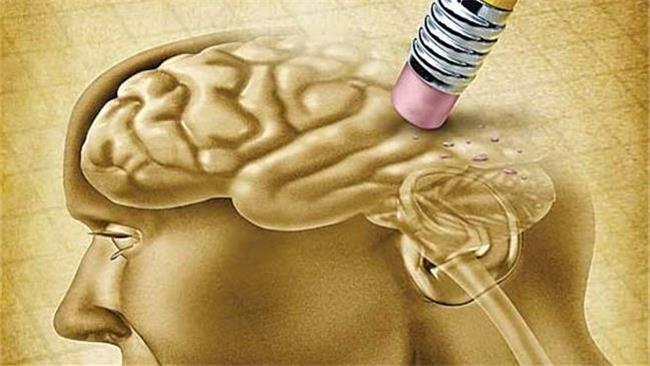 نشانه های زوال عقل